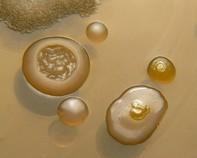 water bacteria water bacteria